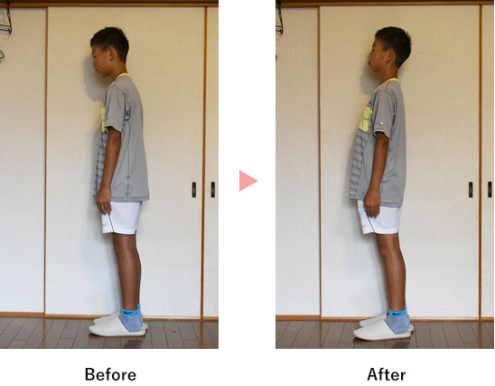 キッズ整体before after